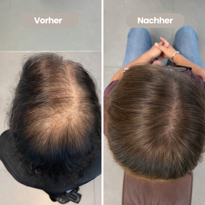 100% natürliches Haaröl - Wachstumsbooster in der Menopause
