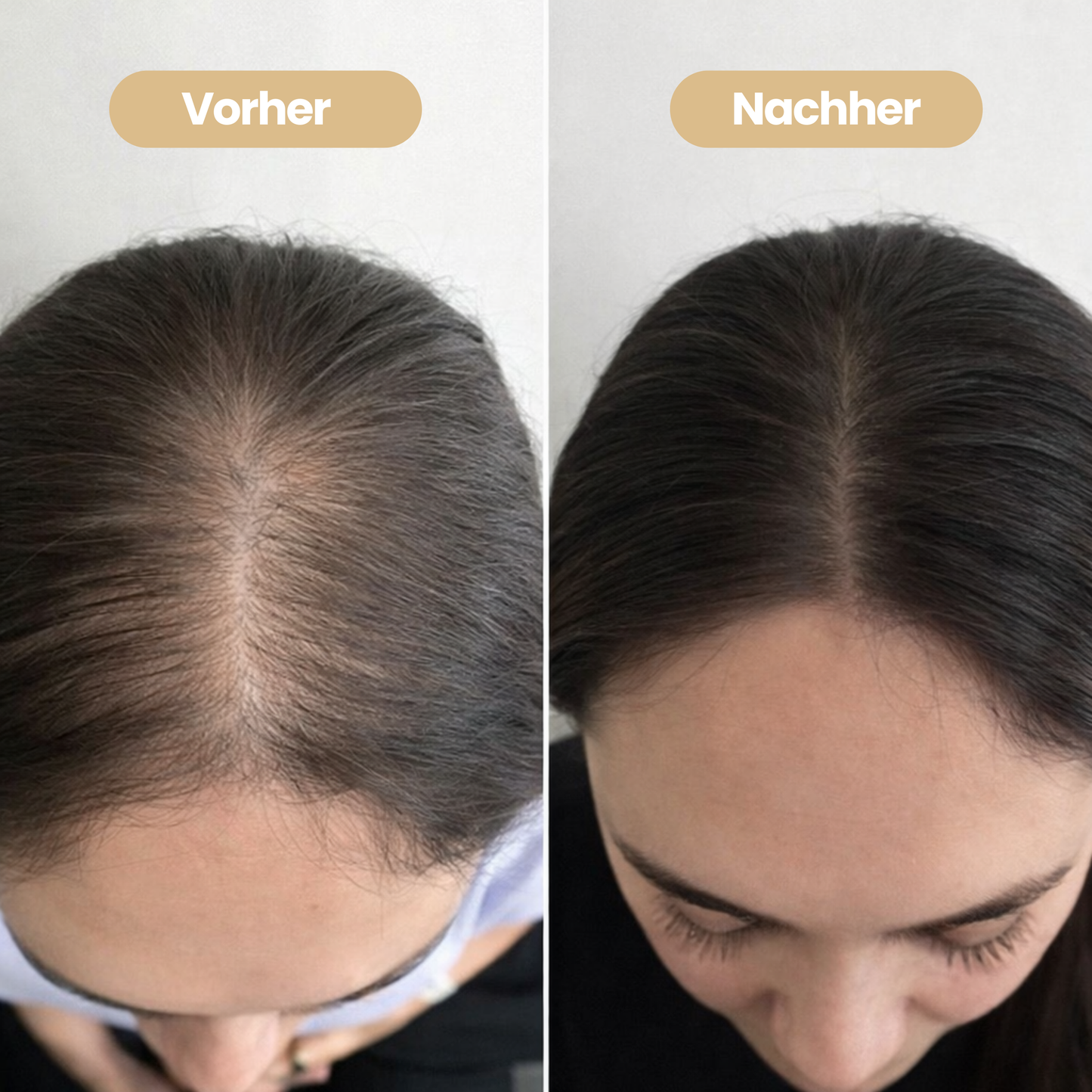 100% natürliches Haaröl - Wachstumsbooster