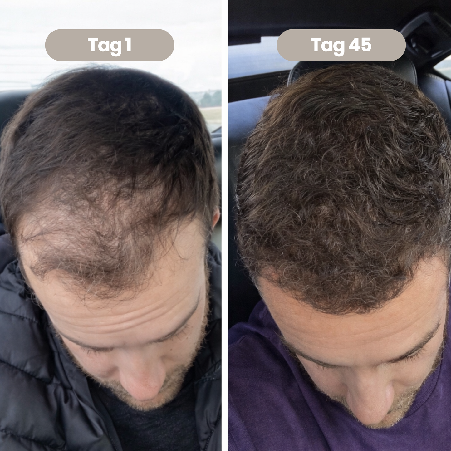 100% natürliches Haarwachstumsöl für Männer