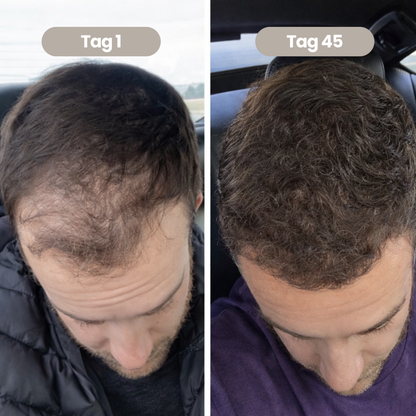 100% natürliches Haarwachstumsöl für Männer