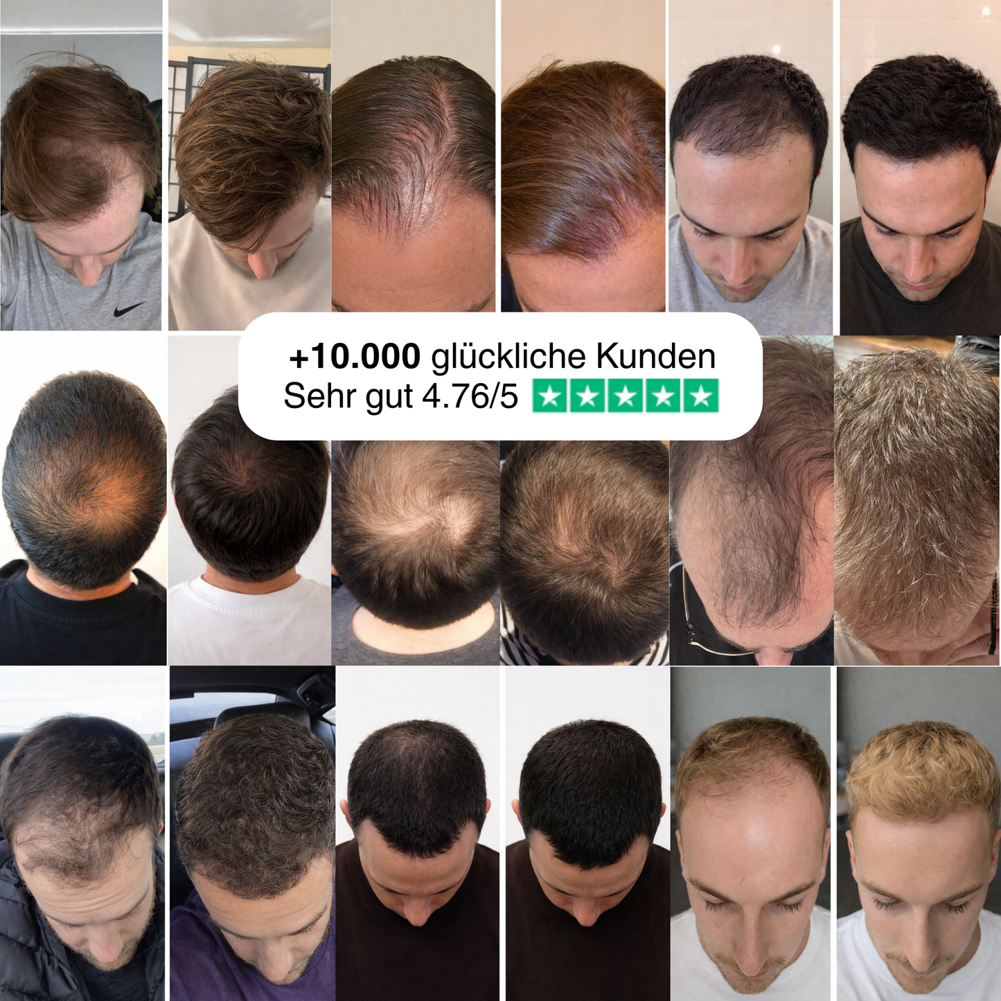 100% natürliches Haaröl - Wachstumsbooster für Männer