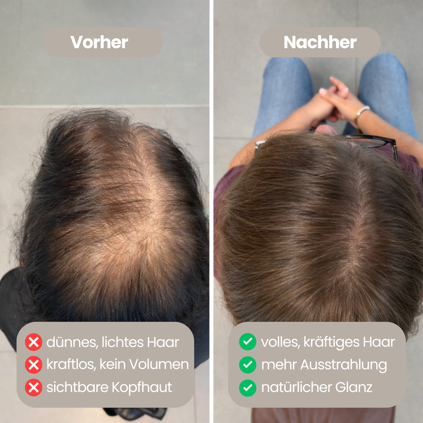 100% natürliches Haaröl - Wachstumsbooster