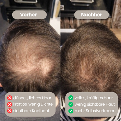 100% natürliches Haarwachstumsöl für Männer