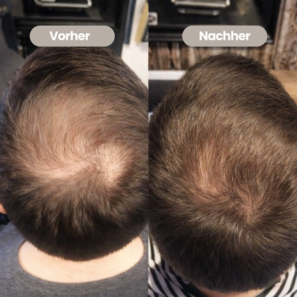100% natürliches Haaröl - Wachstumsbooster für Männer
