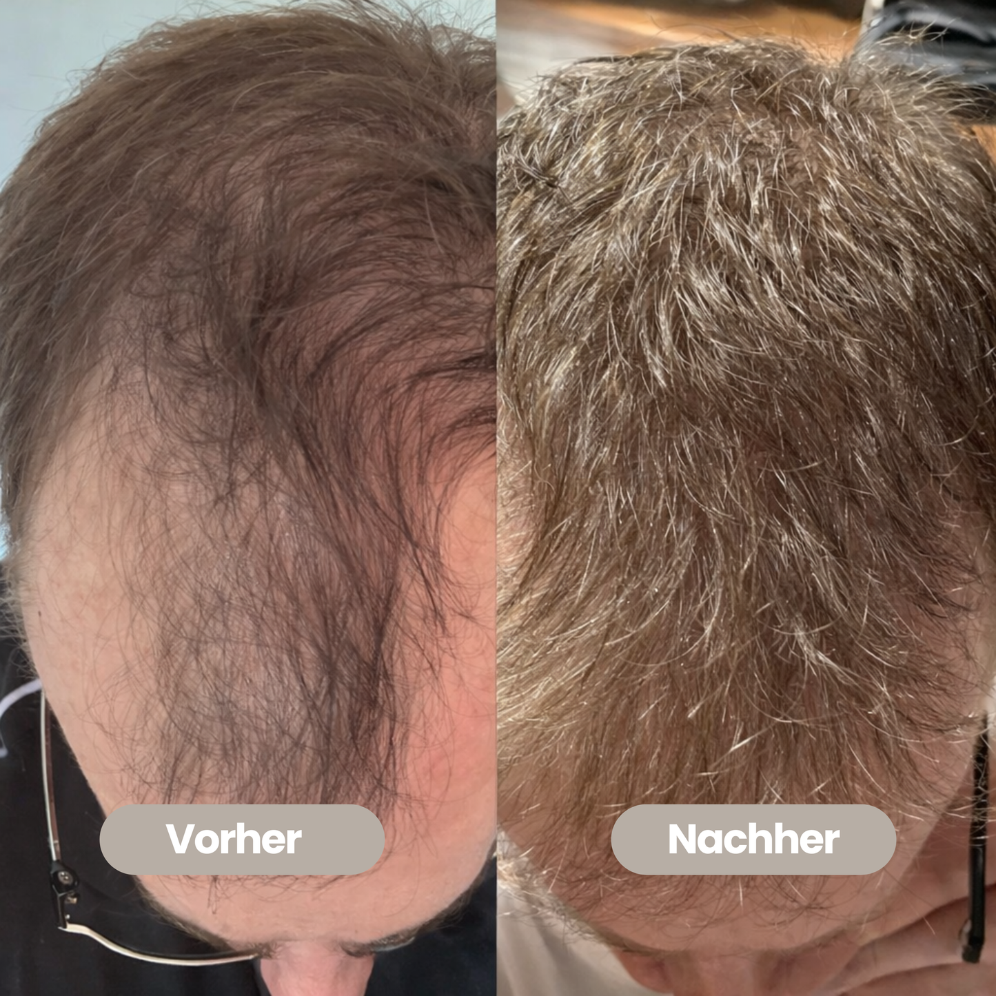 100% natürliches Haaröl - Wachstumsbooster für Männer